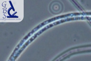 GBS: Curso de Identificación de Bacterias Filamentosas en Fangos Activos Industriales