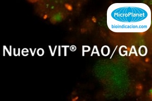 Nuevo kit VIT® PAO/GAO para el control de bacterias en procesos de eliminación biológica mejorada de fósforo