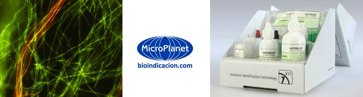 Nuevo kit VIT® Chloroflexi para detección de bacterias filamentosas en EDAR