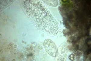Estudio de los Procesos Microbianos Implicados en el Tratamiento de Aguas Residuales Urbanas Mediante Biorreactores de Membrana Sumergida